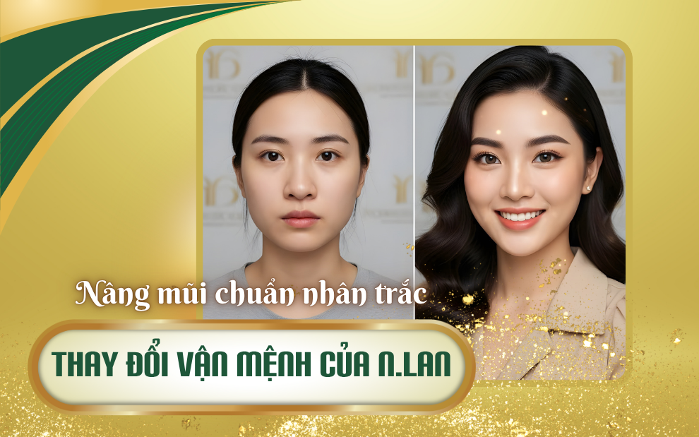 Chuẩn nhân trắc