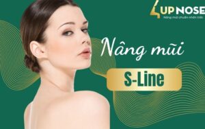 nâng mũi s line là gì