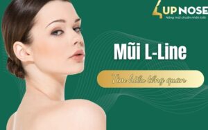 Mũi L-Line