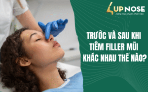 quy trình tiêm filler mũi chuẩn y khoa