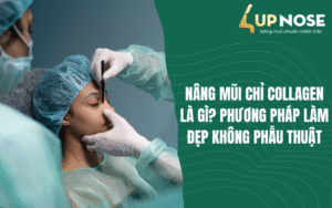 nâng mũi chỉ collagen