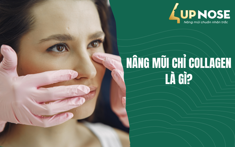 Nâng mũi chỉ Collagen là gì