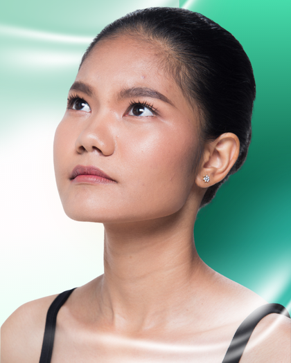 Ảnh trước nâng mũi