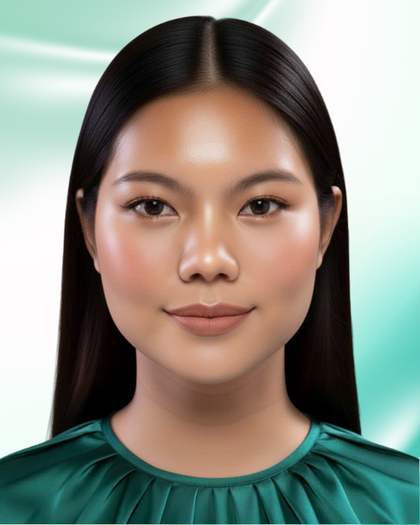 Ảnh sau nâng mũi