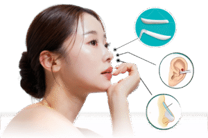 nâng mũi surgiform