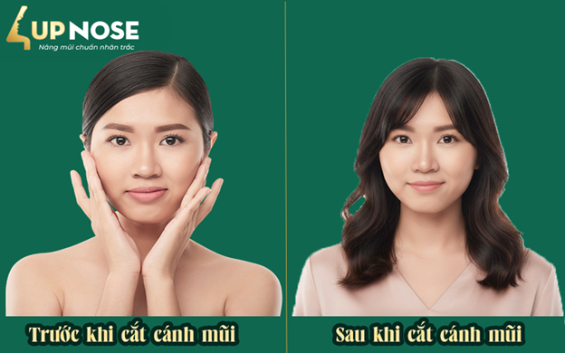 thu nhỏ cánh mũi