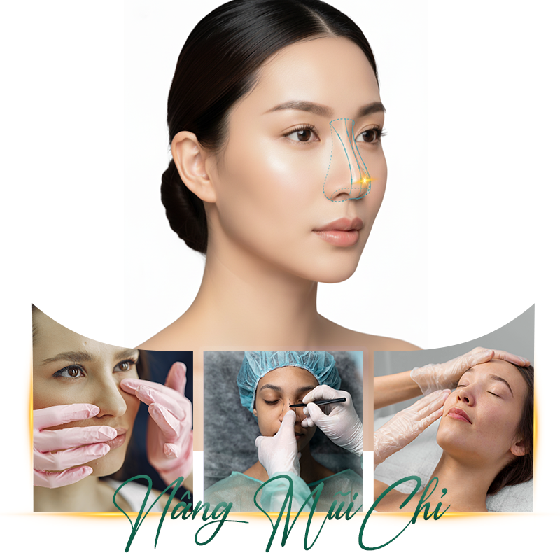 nâng mũi chỉ giá bao nhiêu