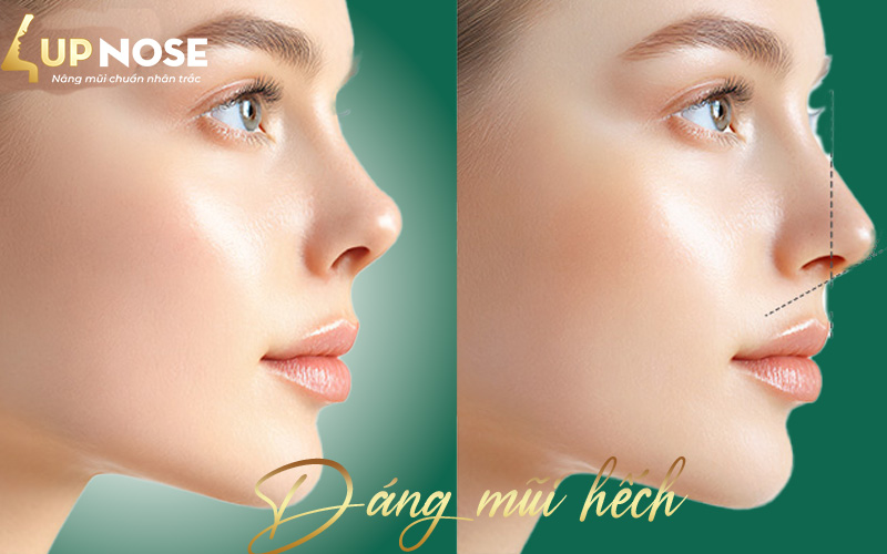 tướng số dáng mũi hếch